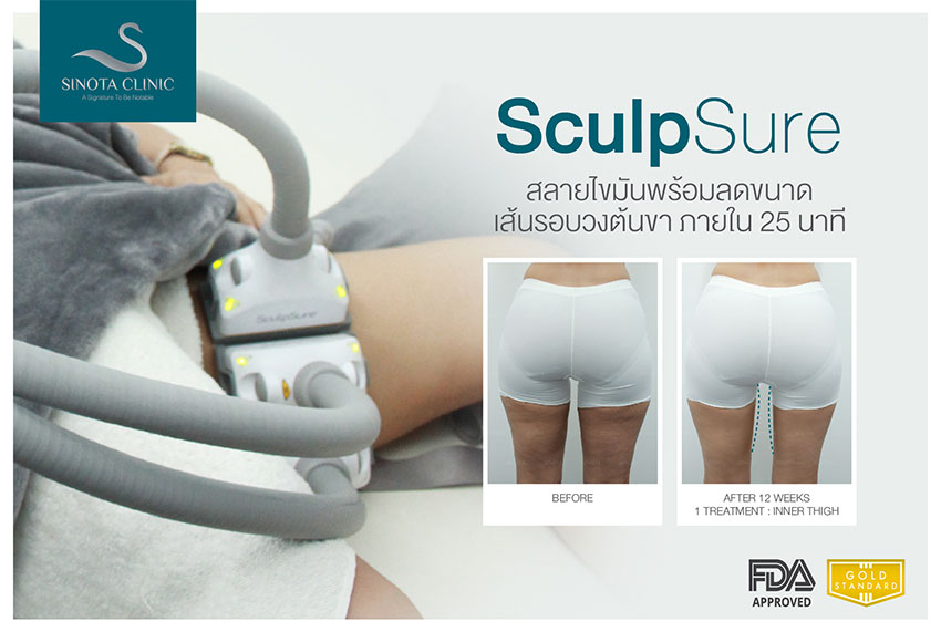 Sculpsure 體外雷射溶脂新知探索 景升診所