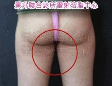 瘦大腿前