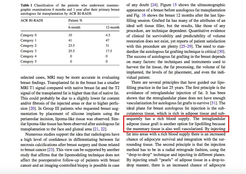法國醫師 Illouz 在一篇『自體脂肪隆乳25年的經驗』論文中，認為脂肪打到乳腺反而可以提高脂肪的存活率