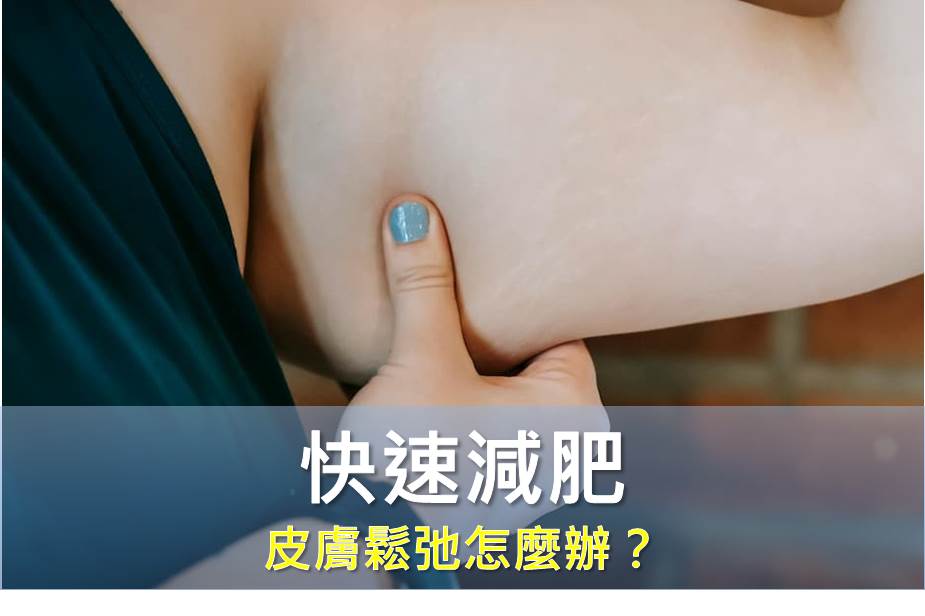 快速減肥後皮膚鬆弛？預防與改善方法全解析！